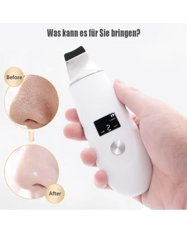 Ultraschallpeelinggerät - 4 Modi